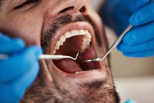 Best Emergency Broken Tooth Repair in Auburn Hills, MI